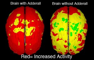 brain on adderall