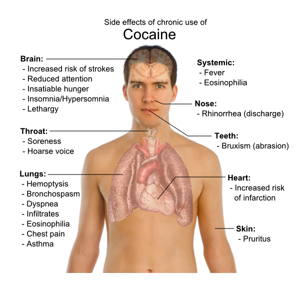 Long Term Effects of Cocaine