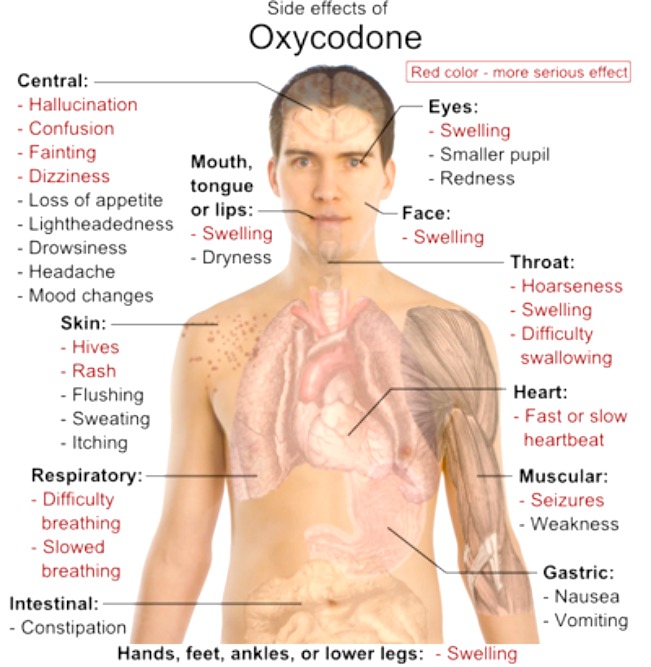 What is Oxycodone? - How Does It Effect The Body and Brain?