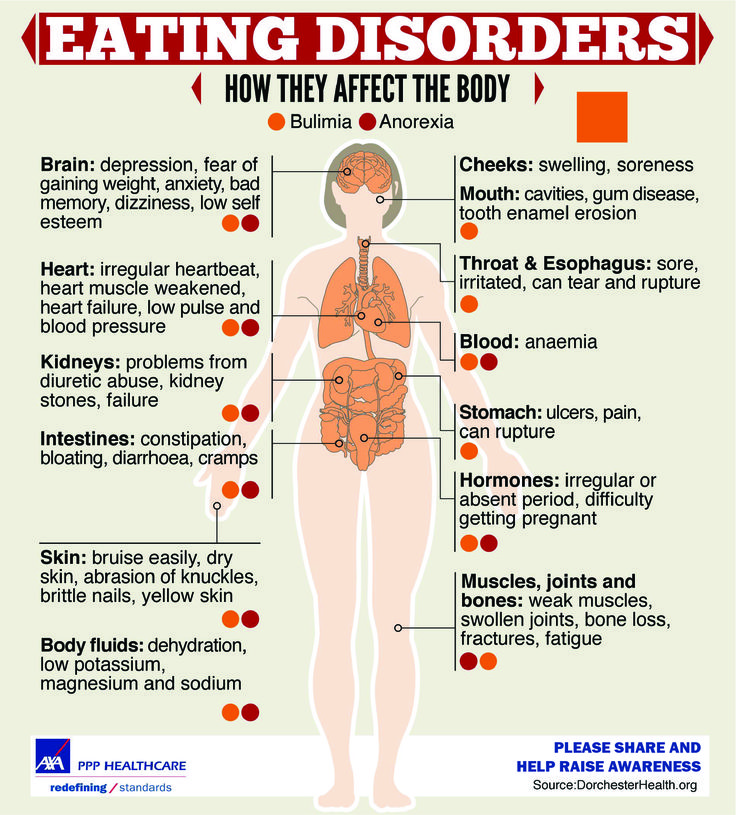 Eating Disorders Explained