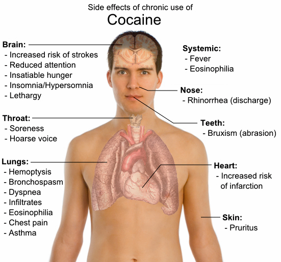 long-term-effects-of-cocaine1