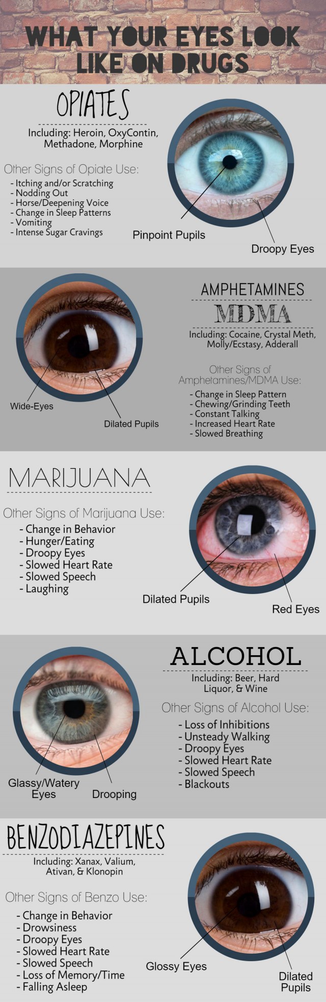 whats your eyes look like on drugs